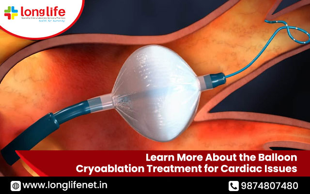 Balloon Cryoablation Treatment for Cardiac Issues