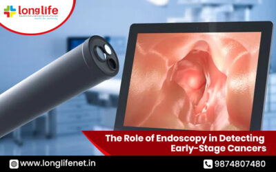 The Role of Endoscopy in Detecting Early-Stage Cancers