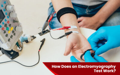 How Does an Electromyography Test Work?