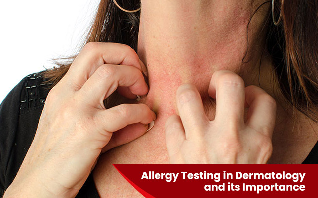 Allergy Testing in Dermatology and its Importance