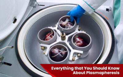 Everything that You Should Know About Plasmapheresis