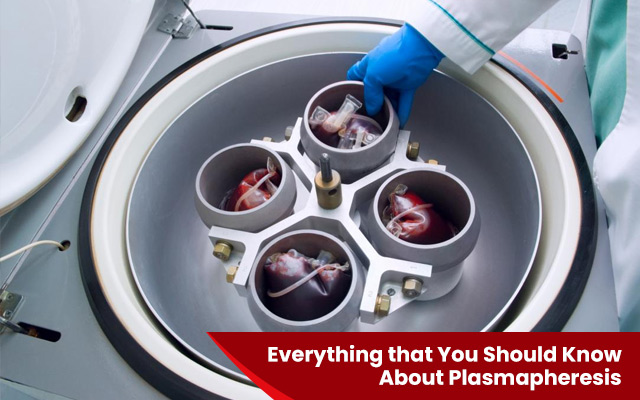Everything that You Should Know About Plasmapheresis