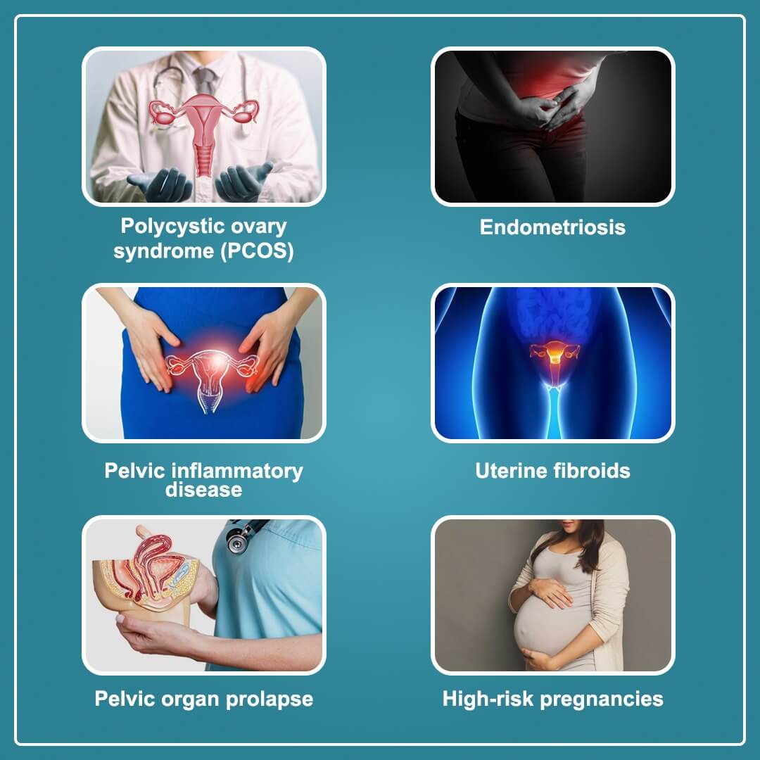 gynecological problems treatment